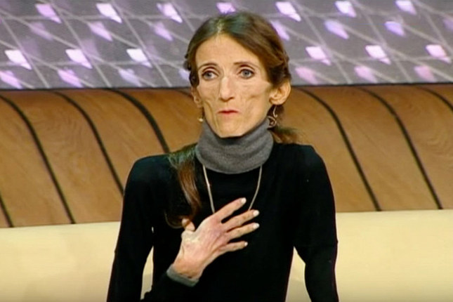 Судьба самой худой женщины планеты. Иммигрантка хотела соответствовать