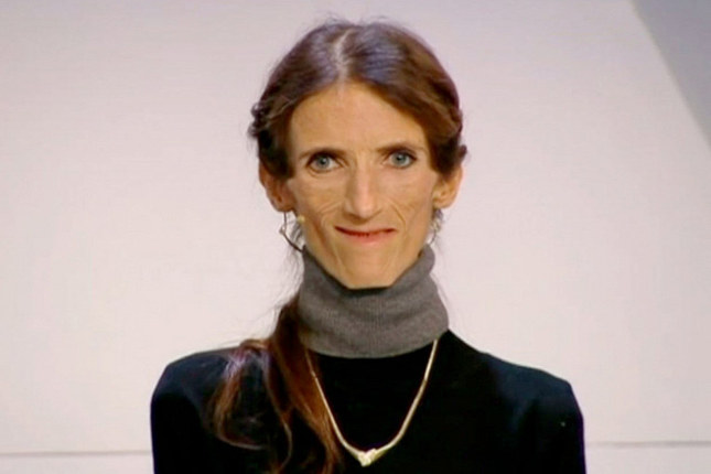 Судьба самой худой женщины планеты. Иммигрантка хотела соответствовать