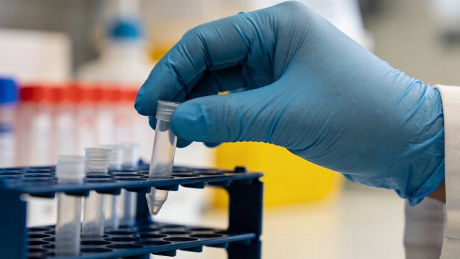 Spain records nearly 38,000 gonorrhoea cases in 2025 RUSSPAIN.com