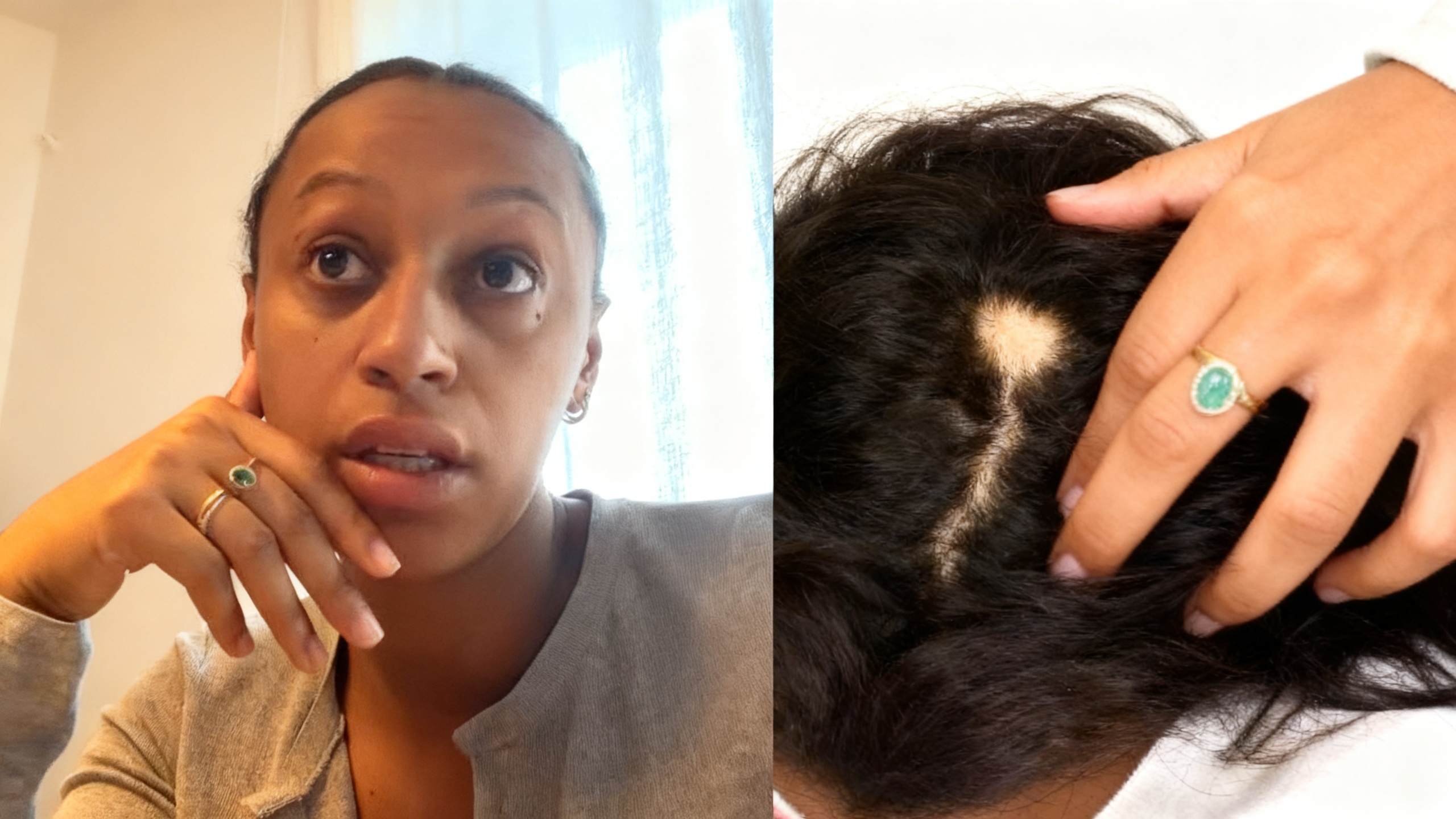 Ana Peleteiro openly shows new bald spot at 33 weeks pregnant RUSSPAIN.com