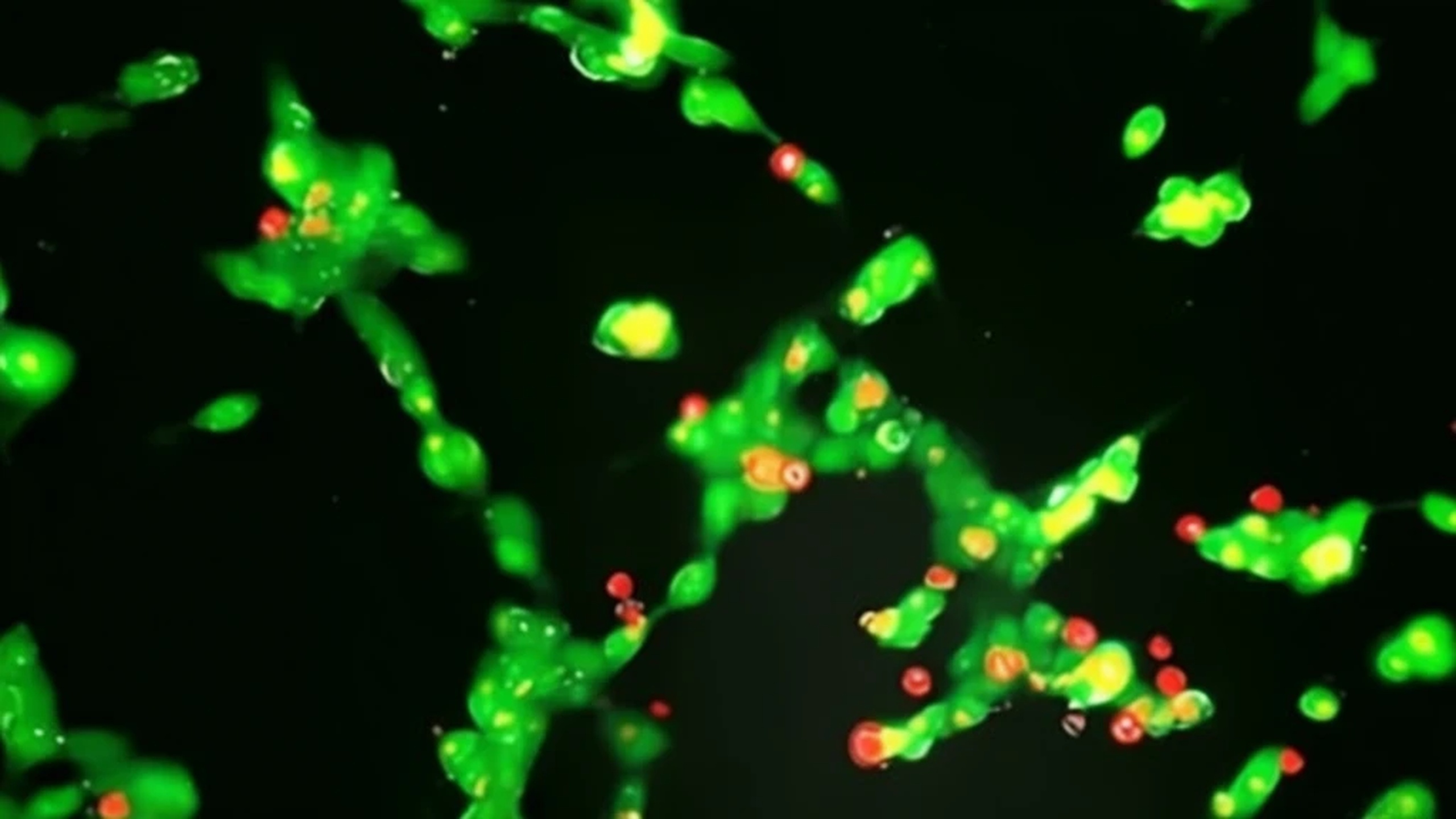 Could nanotechnology revolutionize cancer treatment for children RUSSPAIN.com