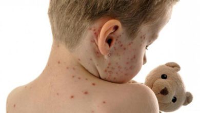 Туристка с двумя детьми не смогла улететь домой из-за ветрянки у детей