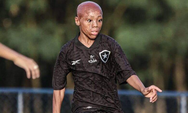 Young Brazilian Footballer Overcomes Severe Burns to Play for Botafogo