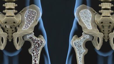 Новый механизм восстановления костей: ученые открыли путь к лечению остеопороза