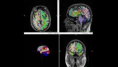 Ученые выяснили как мышечная масса влияет на старение мозга человека