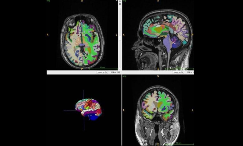 Scientists Discover How Muscle Mass Affects Human Brain Aging