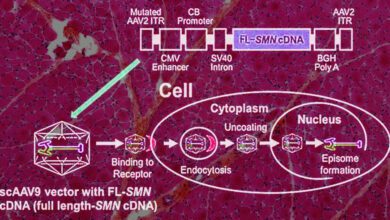 Интратекальная генная терапия открыла новые возможности для лечения СМА у детей и подростков
