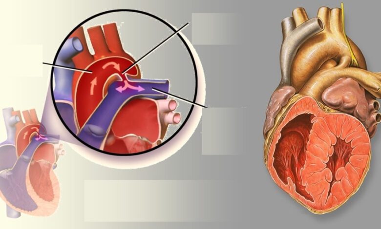 Выжидательная стратегия при открытом артериальном протоке у недоношенных детей снижает смертность
