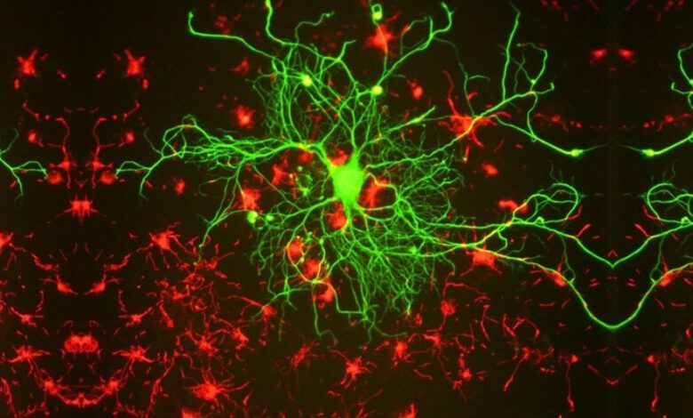 New Biomarker Offers Hope for Patients After Cardiac Arrest