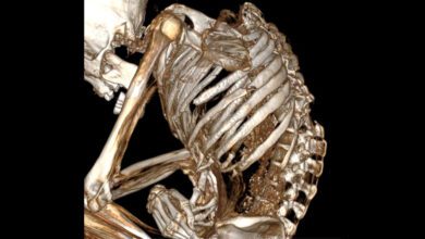 Тайна гибели древнего шахтера Атакамы раскрыта с помощью томографии