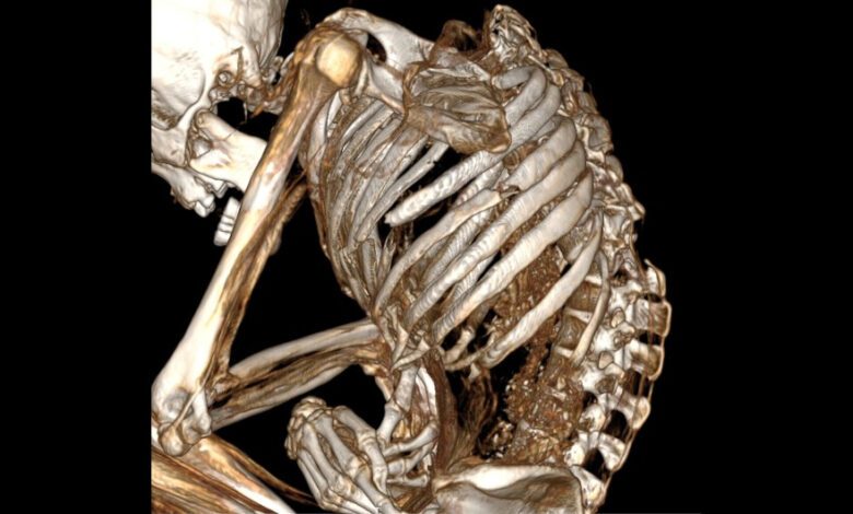 The Mystery of the Ancient Atacama Miner’s Death Solved by Tomography