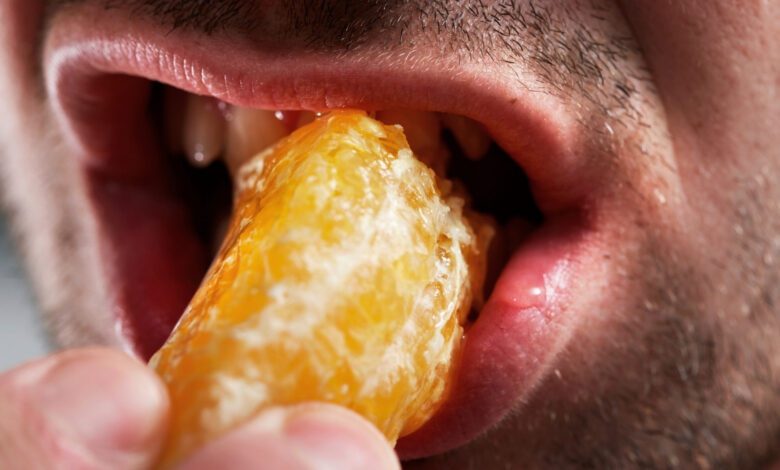 Genetics of Misophonia Linked to Anxiety and Depression in Adults