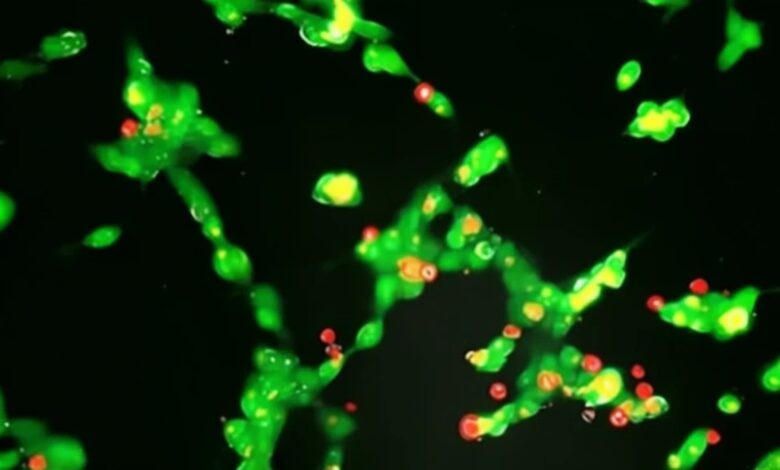 Spanish scientists develop nanotechnology for precise neuroblastoma detection and destruction