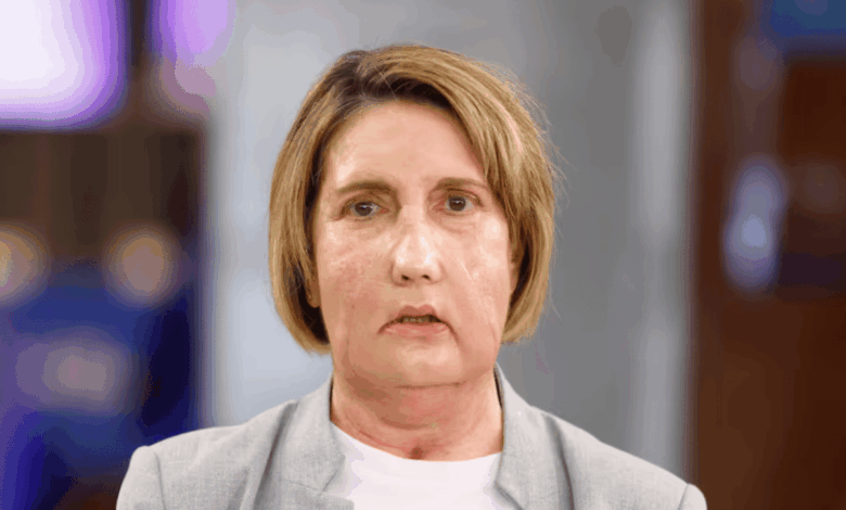 Unique face transplant performed in Barcelona using a donor after euthanasia