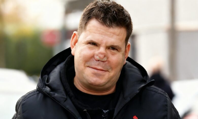 Lucas González проходит новый курс лечения после осложнений операции на носу