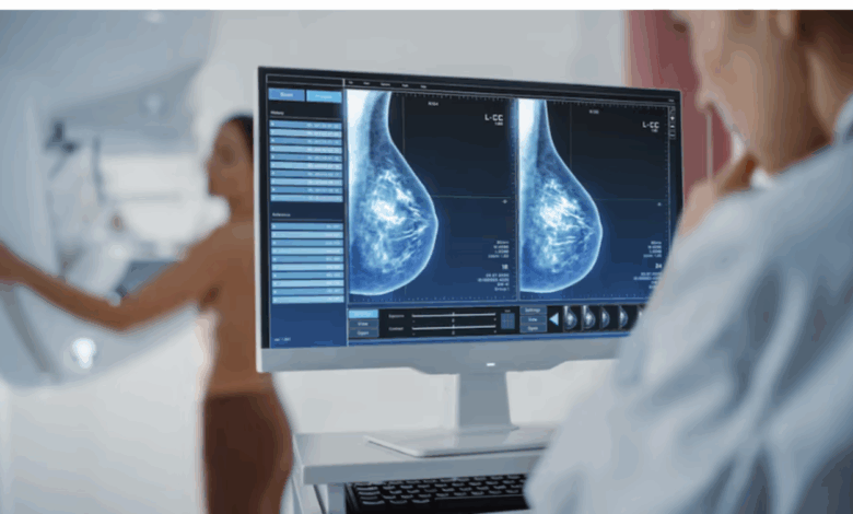 В Испании тестируют 3D-маммографию без боли и радиации: что меняется для женщин