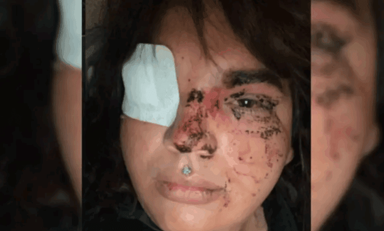 Групповое нападение на Miss Trans Zamora 2024 вызвало волну возмущения в Испании