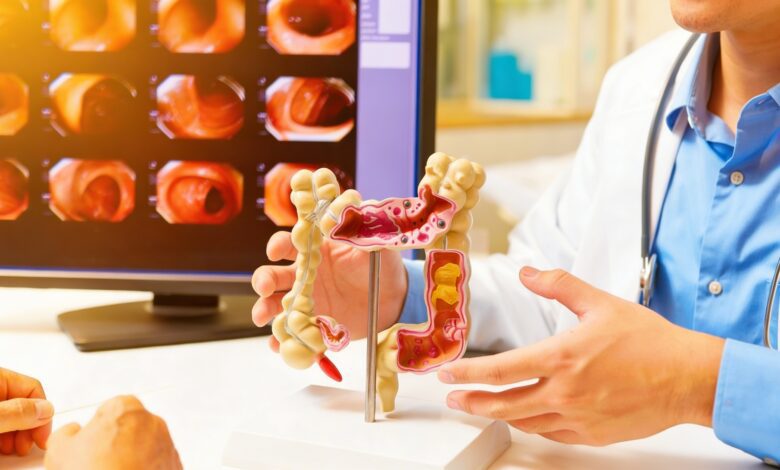 Catalonia expands colorectal cancer screening age to 74