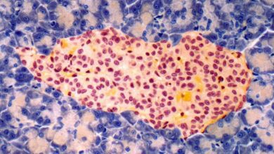 Учёные нашли способ обратить диабет 1 типа с помощью усовершенствованных клеток инсулина RUSSPAIN.COM