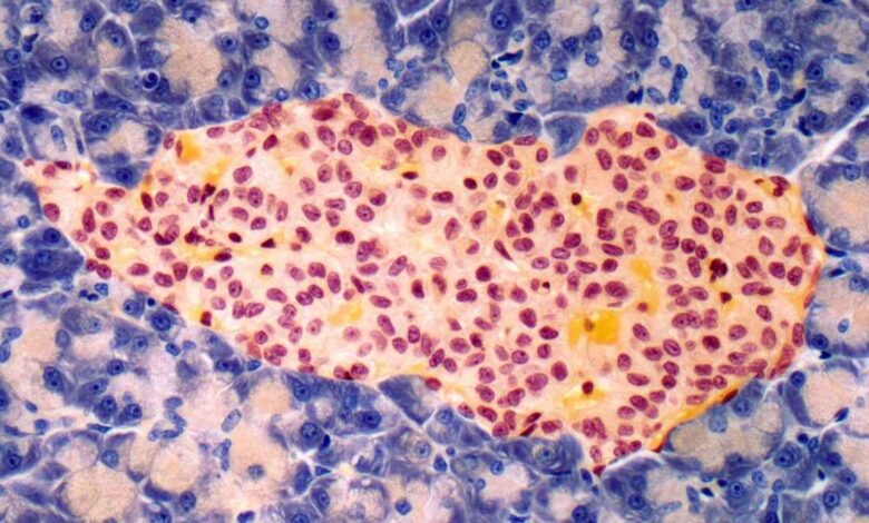 Учёные нашли способ обратить диабет 1 типа с помощью усовершенствованных клеток инсулина