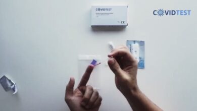 Para realizar la prueba es necesario extraer unas gotas de sangre