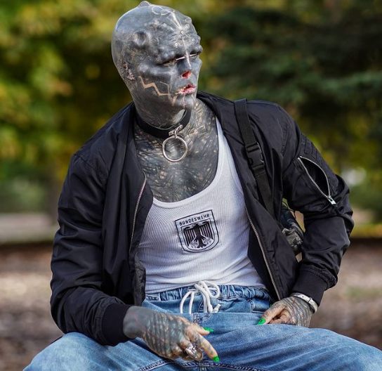 Марка (Испания). «Черный инопланетянин» хочет ампутировать себе ногу после удаления пальцев, ушей, носа. «Полная дегуманизация»