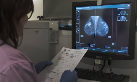 Over 90,000 Women in Valencia Missed Mammography Invitations