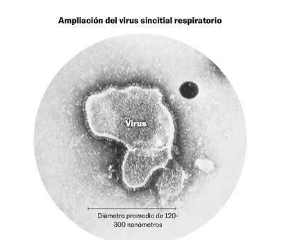En España, una nueva inmunización evitó miles de hospitalizaciones de bebés con bronquiolitis