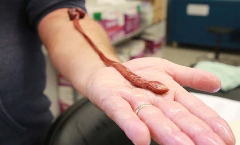 В США обнаружили самого долгоживущего ленточного червя в истории науки